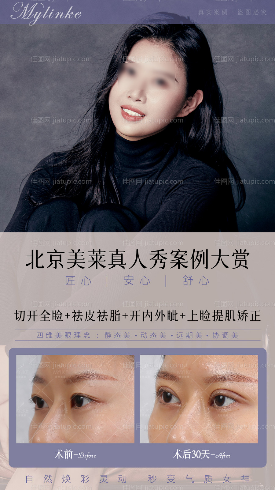 医美案例模板-源文件